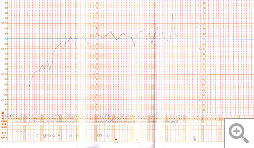 基礎体温グラフ